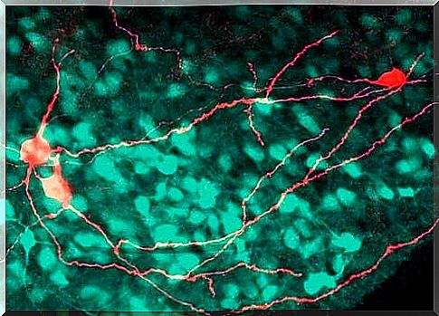 The insular cortex and its relation to painful events