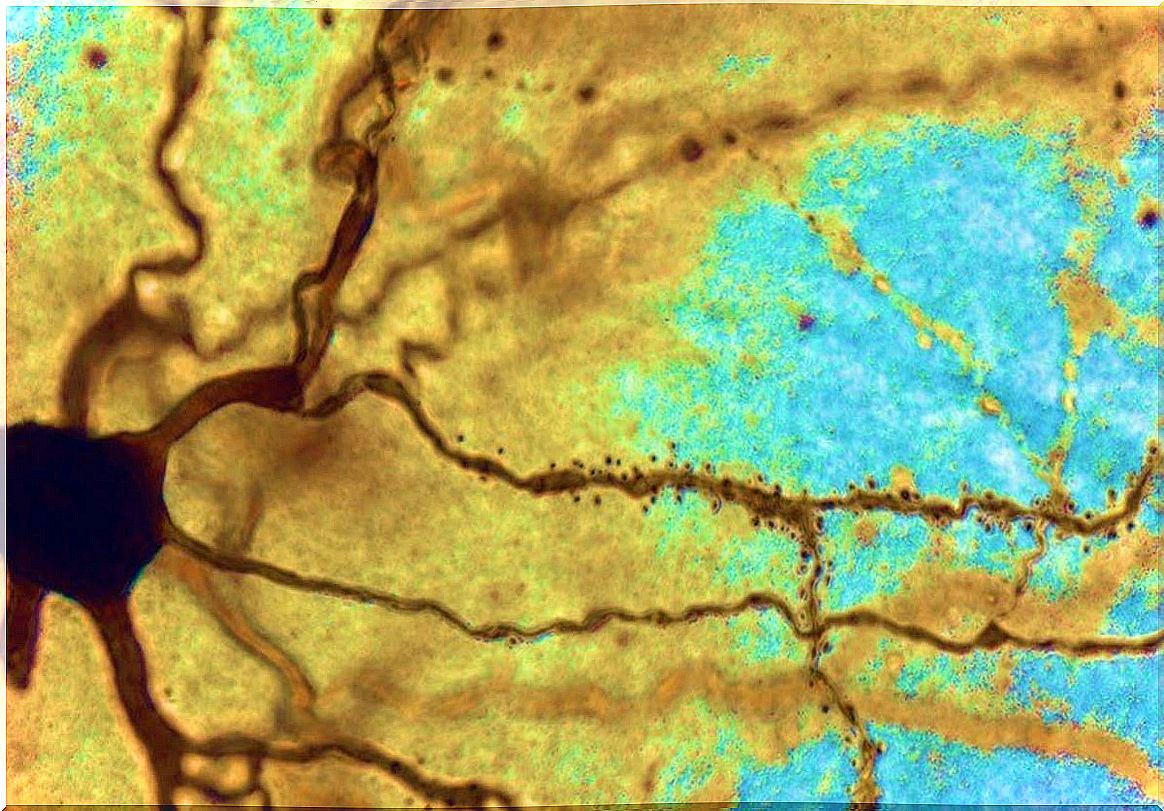 cells representing the neurons of intelligent people are larger