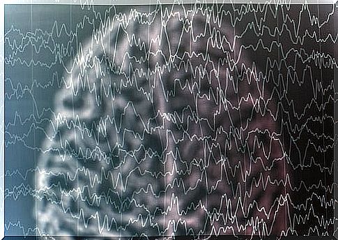 Brain with brain wave drawing